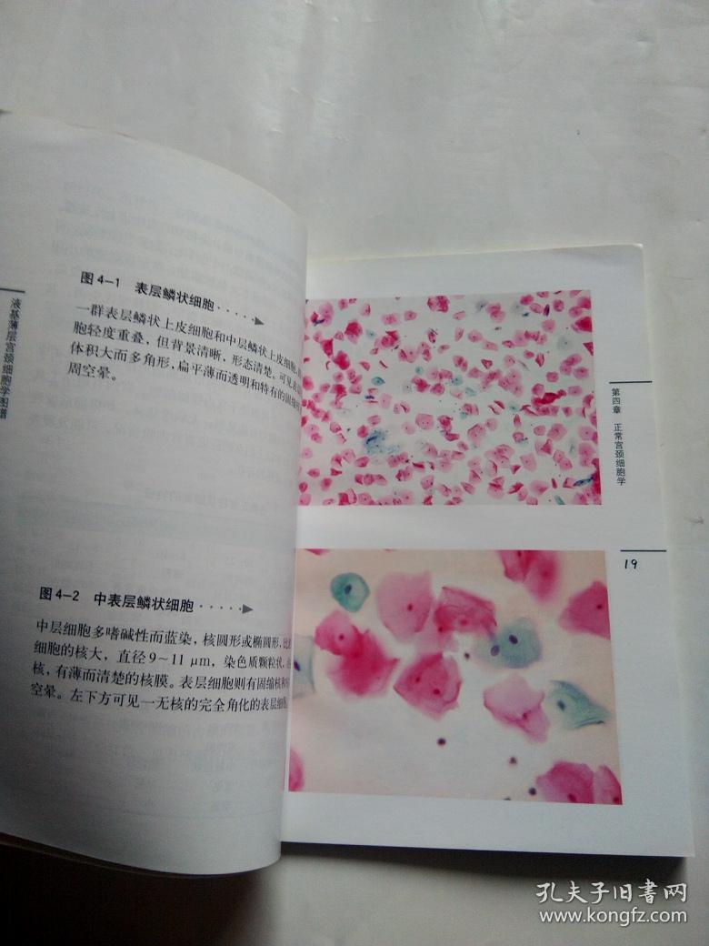 液基薄层宫颈细胞学图谱