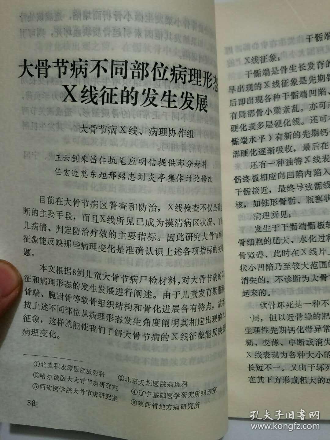 大骨节病x线病理研究(30元包邮)