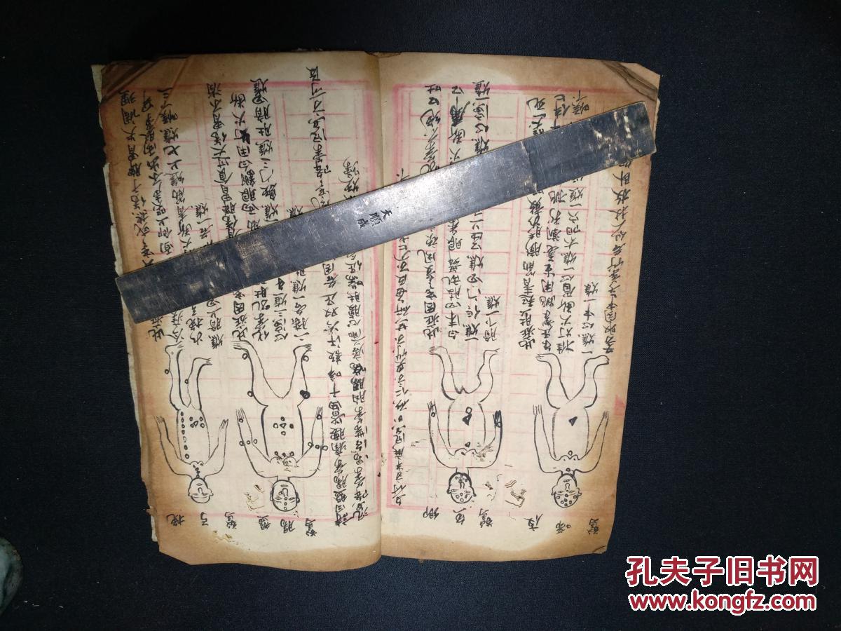 纲儿科,小儿惊风穴位按摩推拿用药手抄,精细人物手绘图,九页十八面手