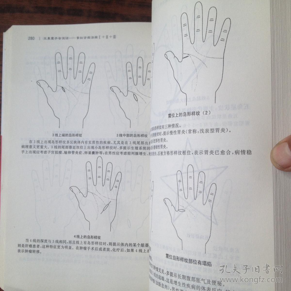 王晨霞手会说话掌纹诊病治病全图解--巨厚本