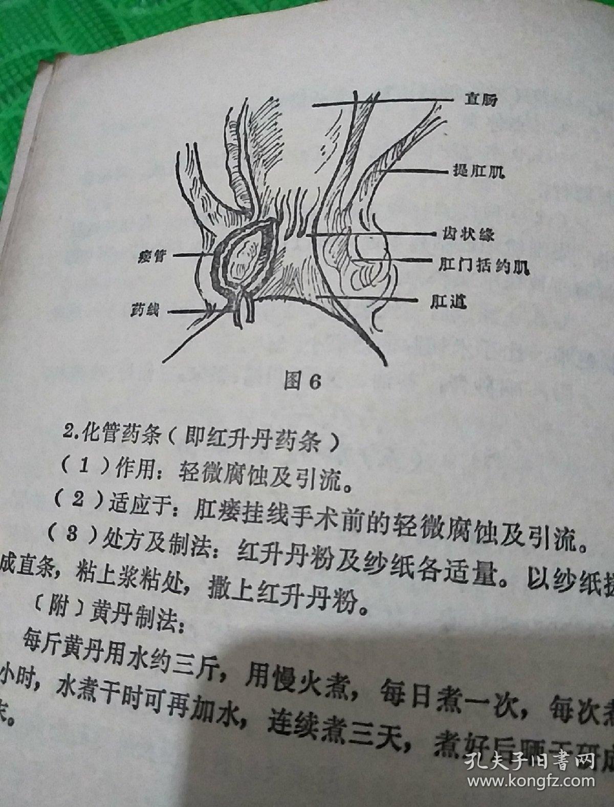 痔疮与肛瘘的防治