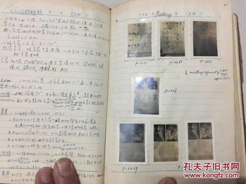 50年代上海广慈医院放射影像专家宋子根医学