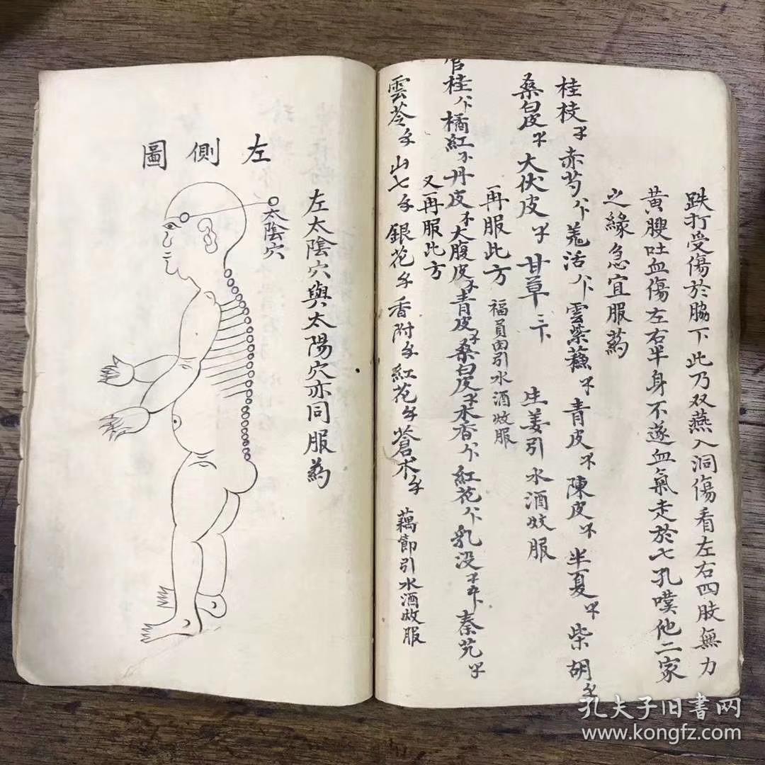 稀见 大清光绪 中医手钞秘本《跌打接骨秘方》一册全