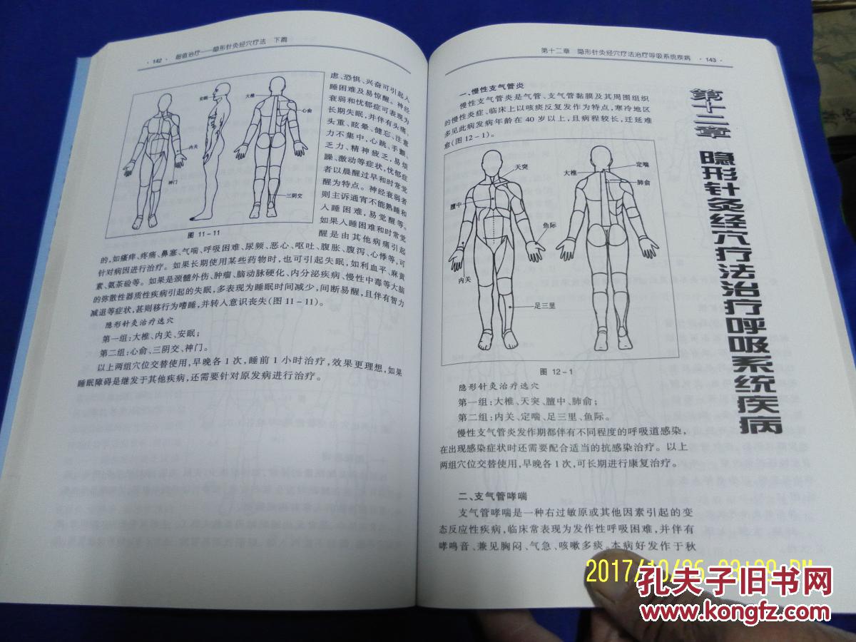 超值治疗-----隐形针灸经穴疗法 16开 (新型无痛针灸的创新原理.