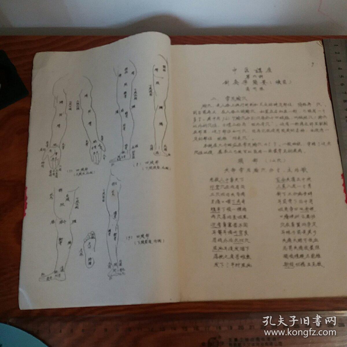 文革安徽中医油印针灸学图文并茂,病症针灸疗法处方,主穴,配穴,加减