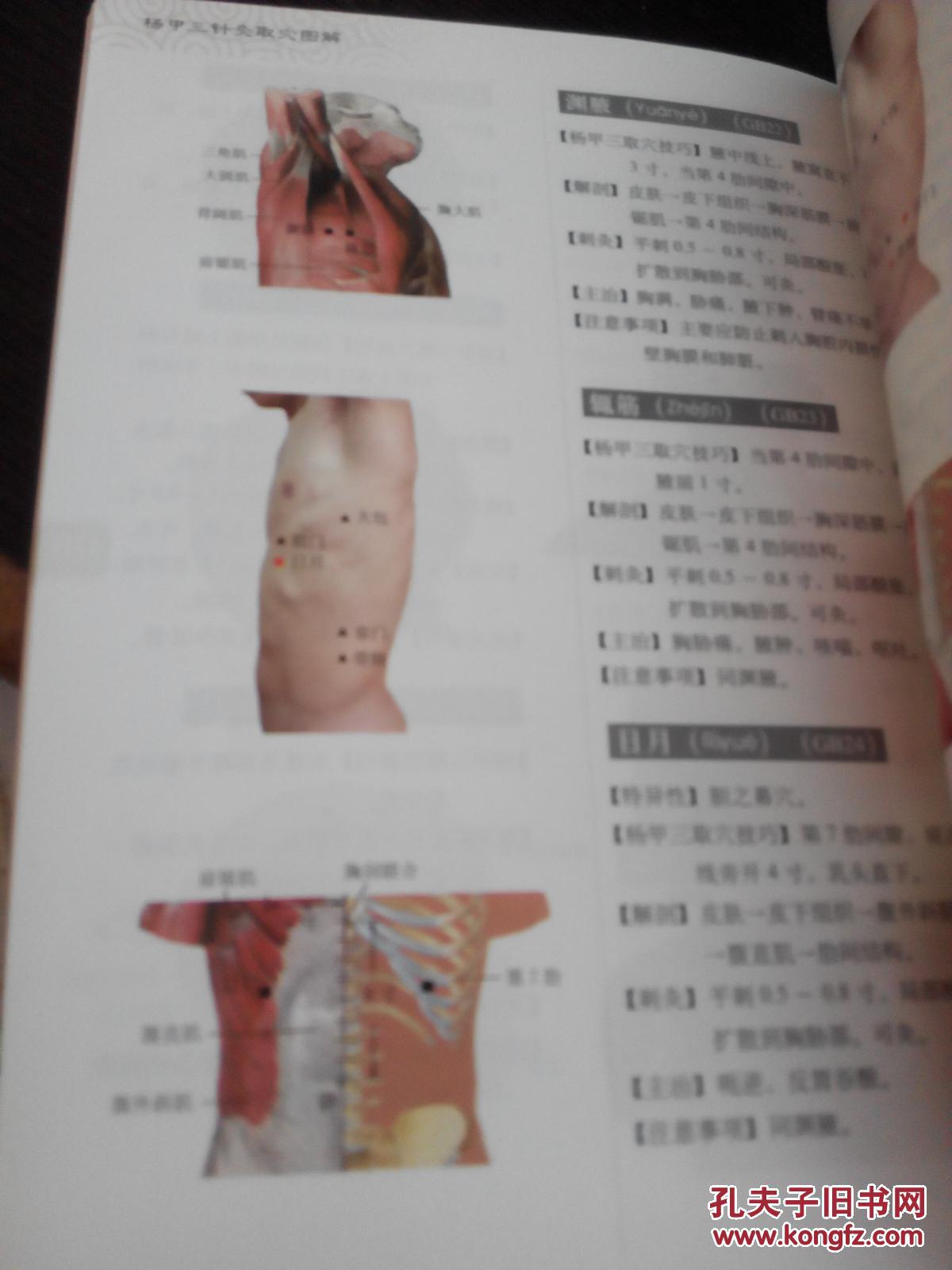 杨甲三针灸取穴图解 彩图版