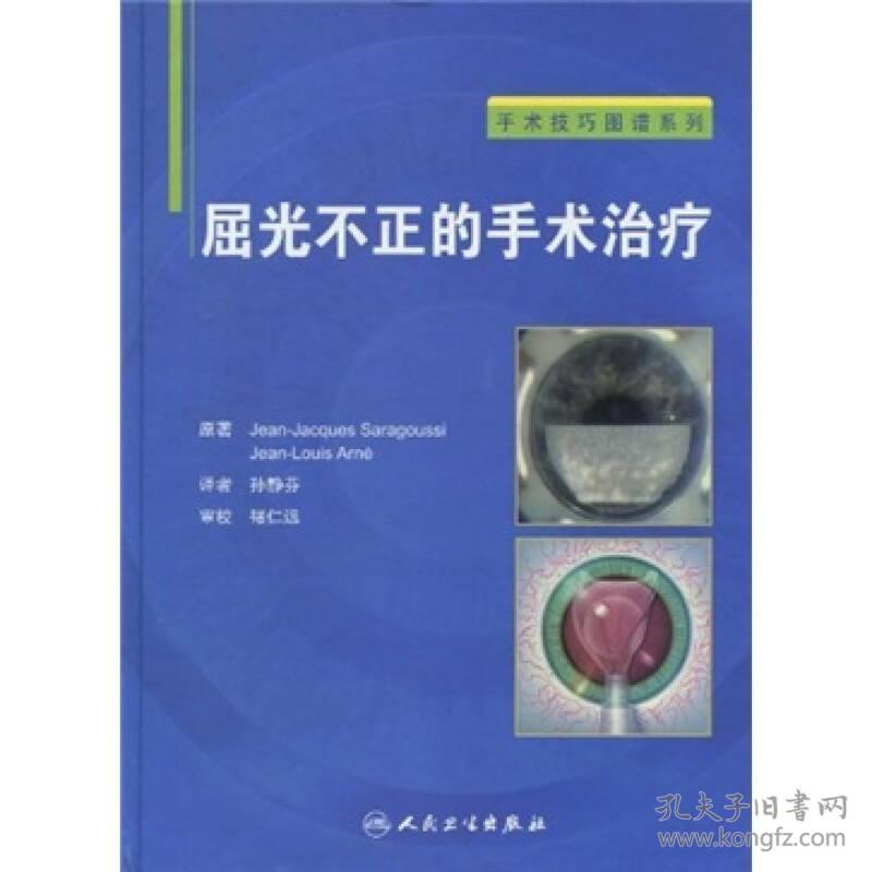 屈光不正的手术治疗