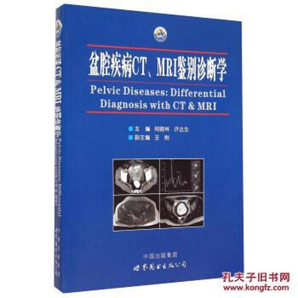盆腔疾病CT、MRI鉴别诊断学 [Pelvic Disease