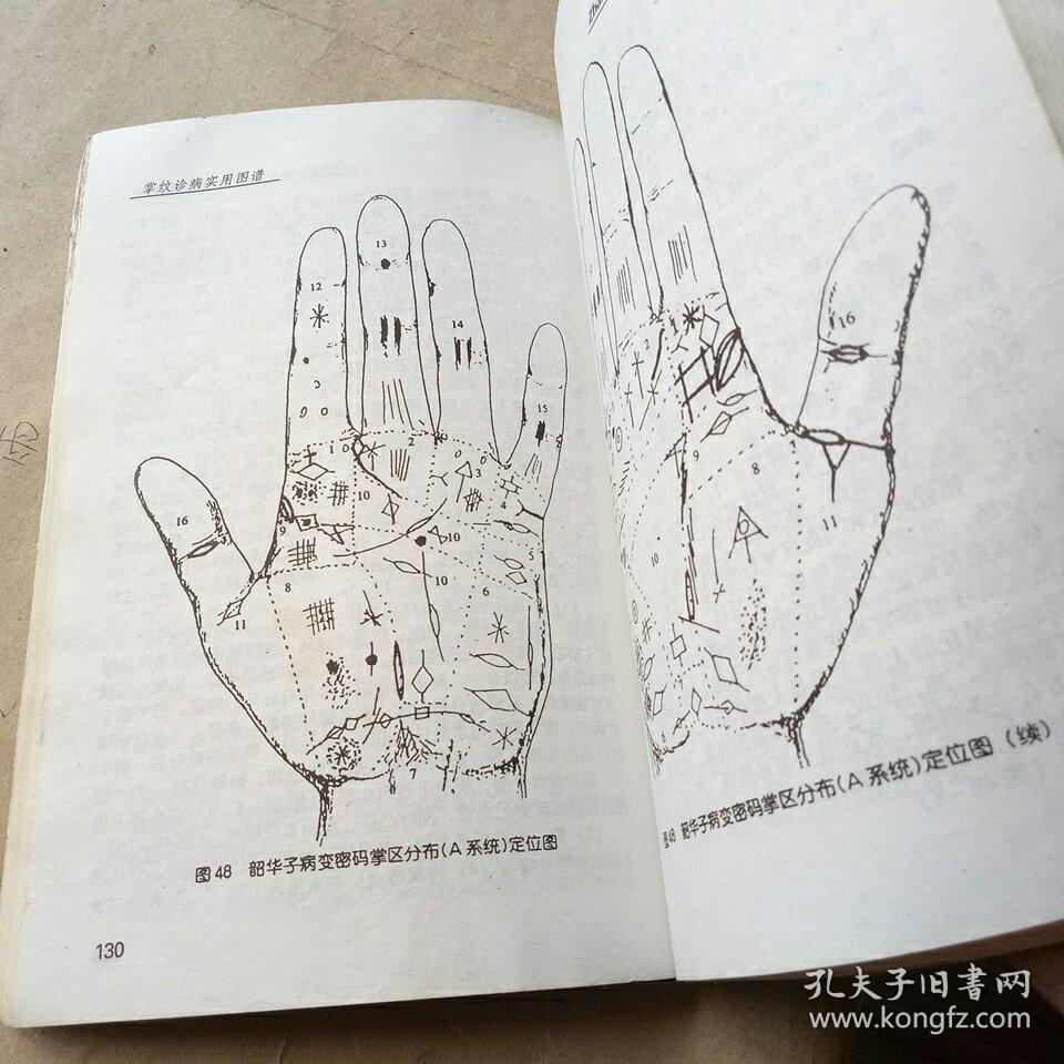 掌纹诊病实用图谱
