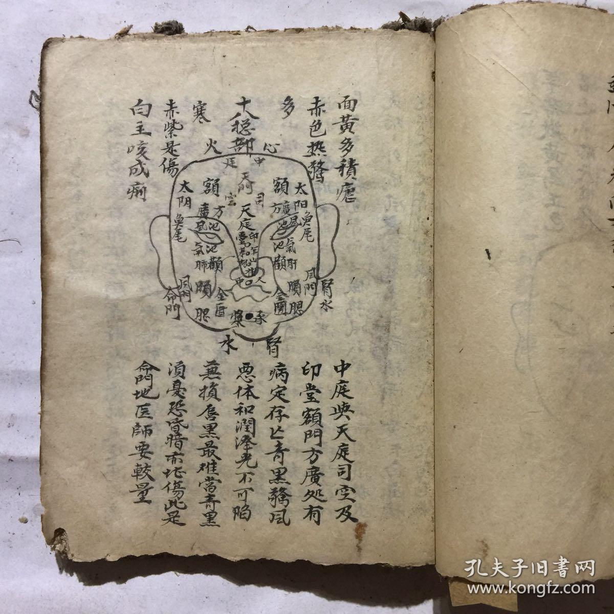 清代中医手抄本:导引法带插图,秘传小儿科书,论小儿不治总论,随便验症