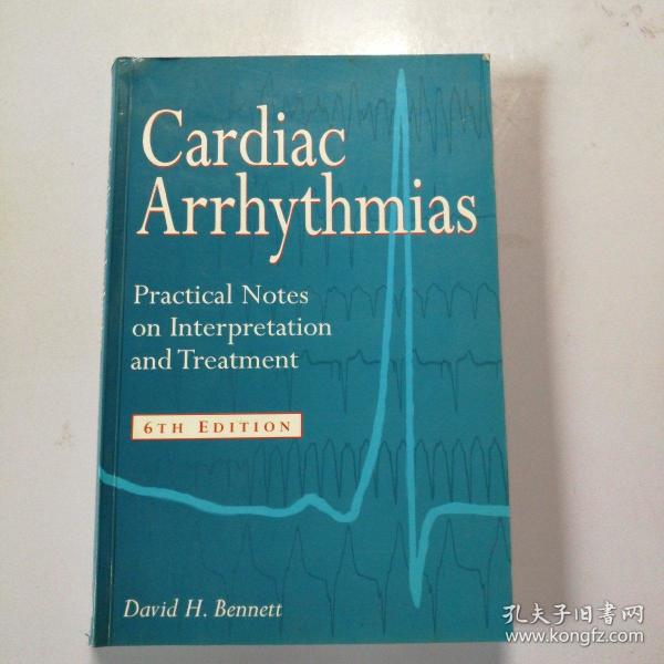 cardiac arrhythmias