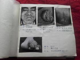 皮肤科资料集【兰州军区总医院】