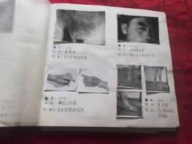 皮肤科资料集【兰州军区总医院】