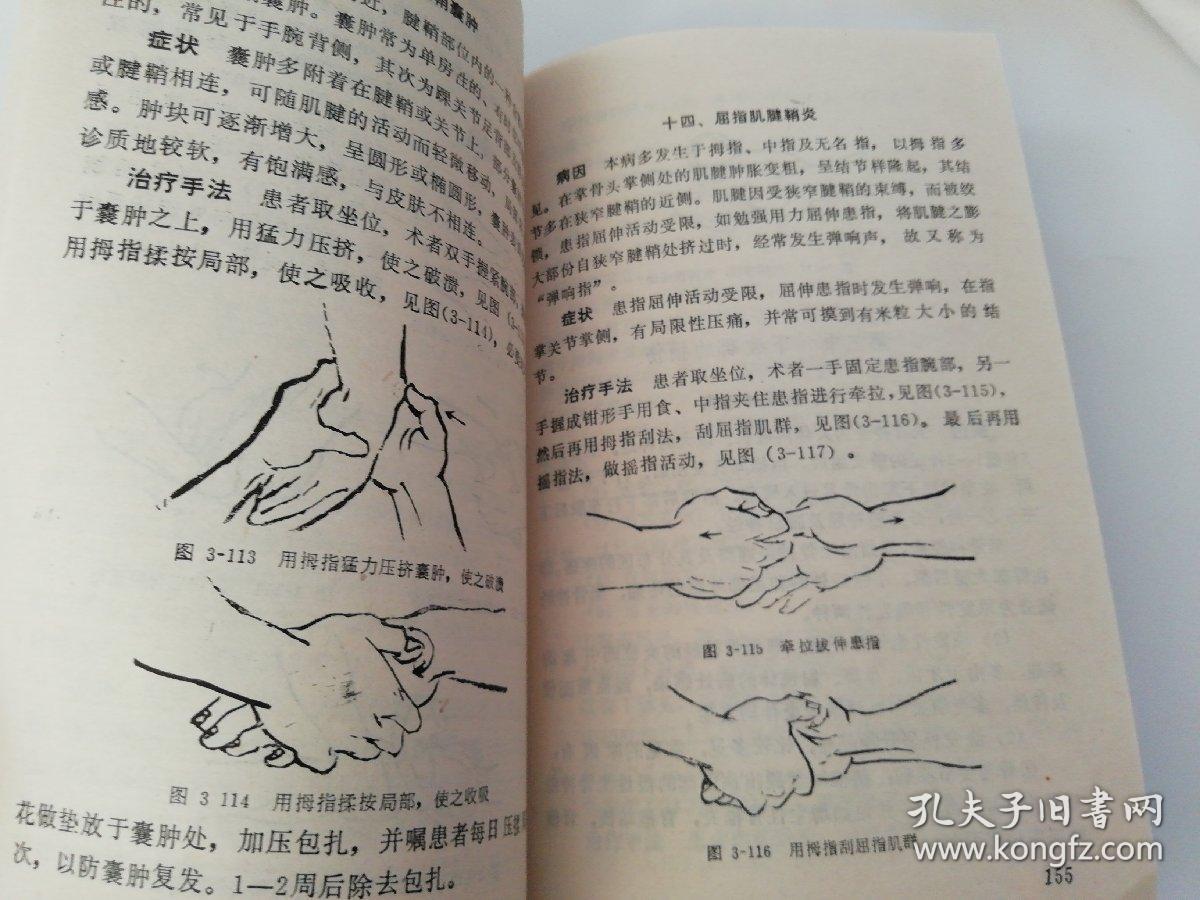 捏筋拍打疗法