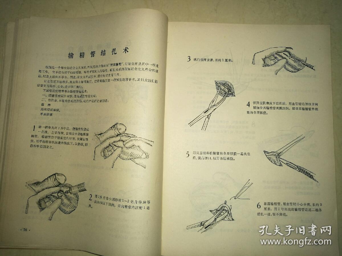 常用手术图解