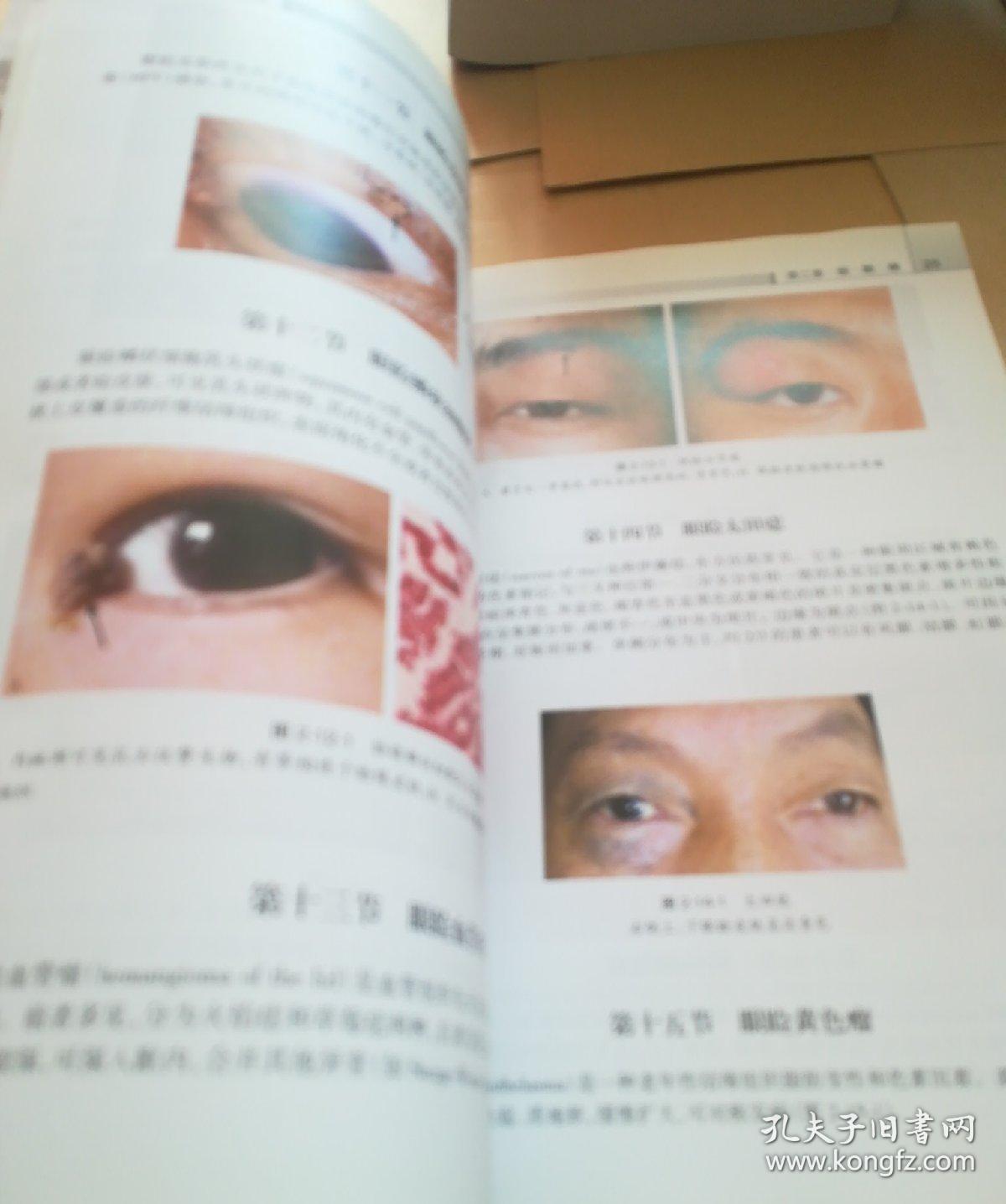常见眼病诊断图谱