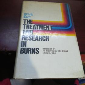 the treatment and research in burns
