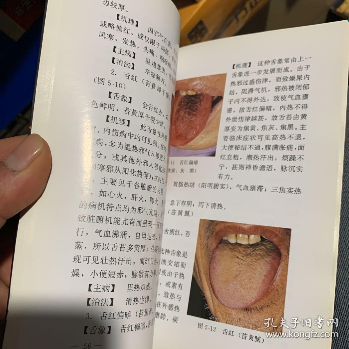 中医舌诊知识