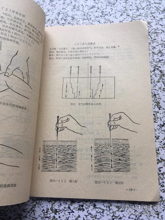 针灸按摩补泻解说
