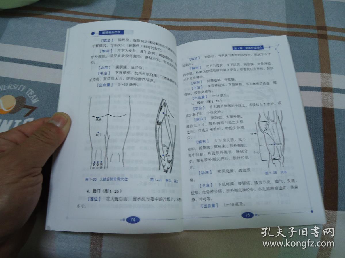 图解刺血疗法