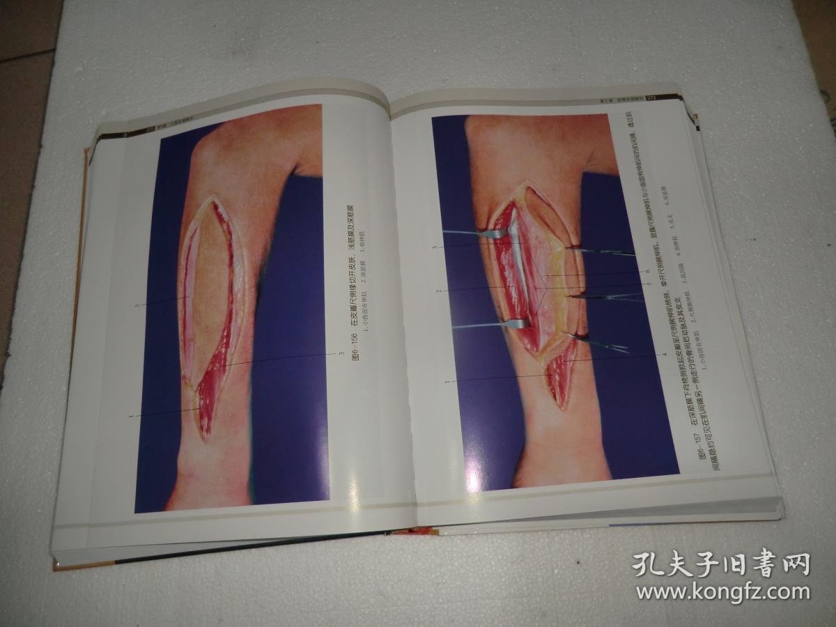 显微外科临床解剖学图谱 第2版 ad2702-2_钟世镇,王增涛,王一兵 编_孔