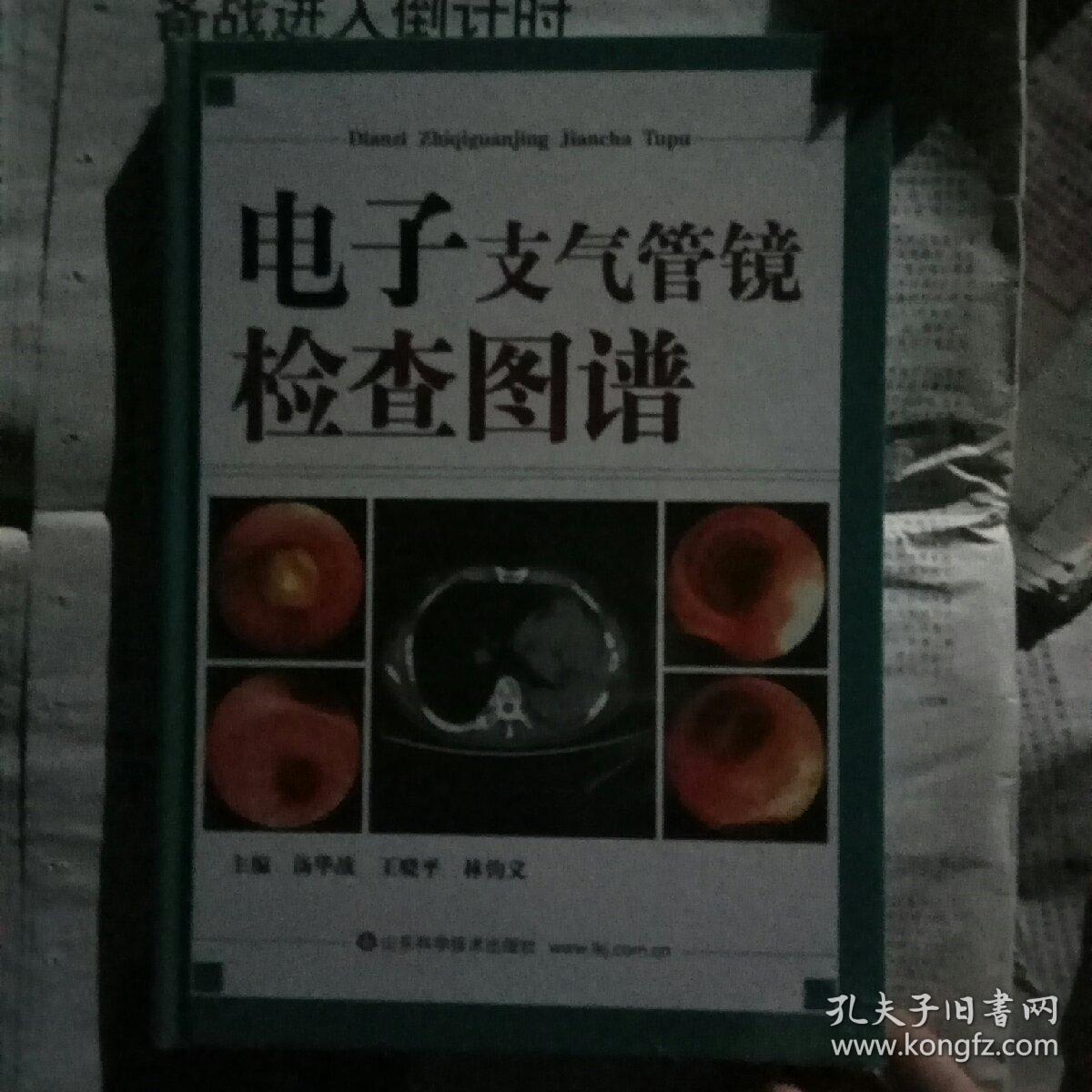 电子支气管镜检查图谱