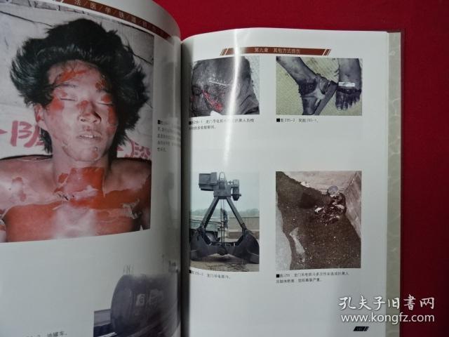 法医学铁道损伤图谱