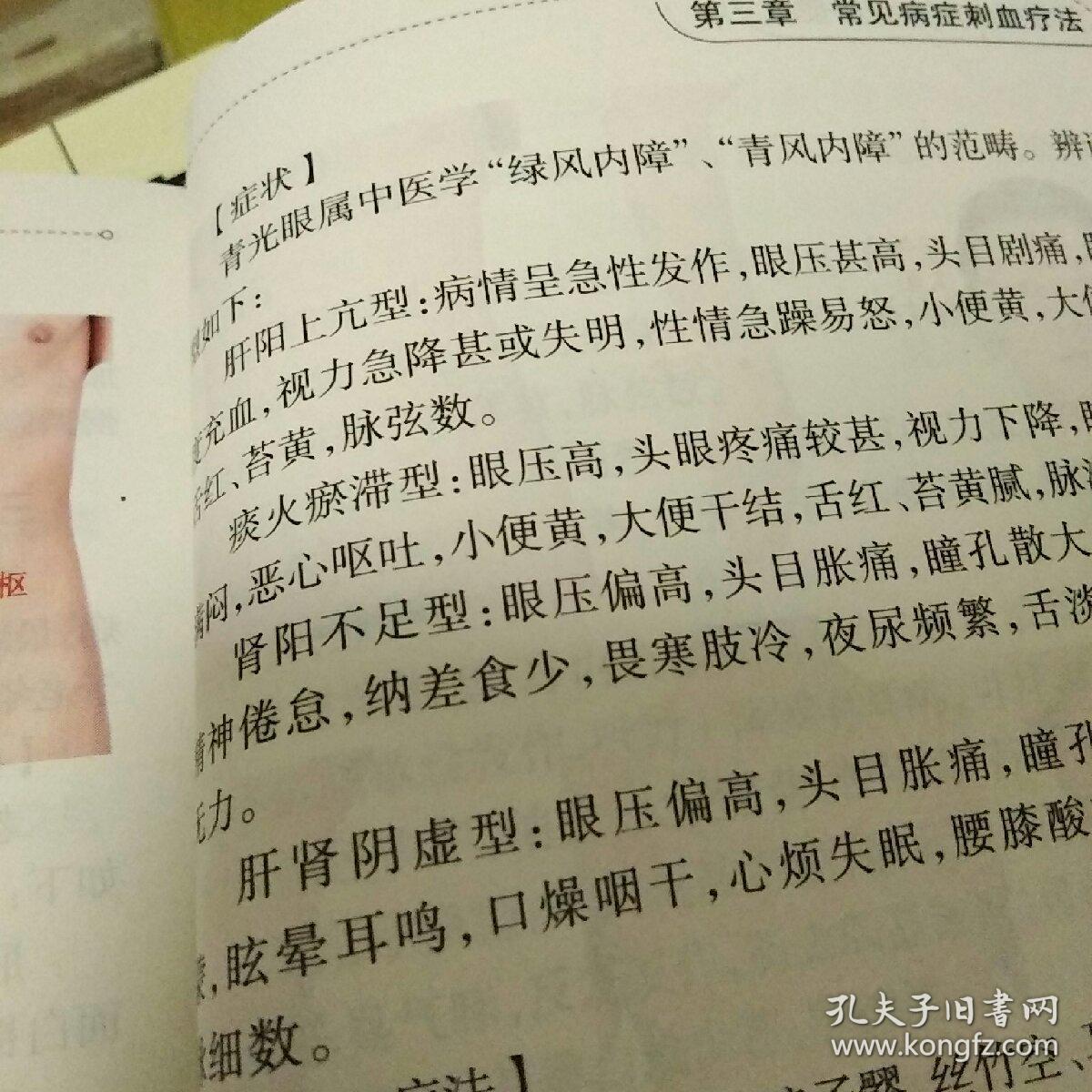 实用针灸刺血疗法便览