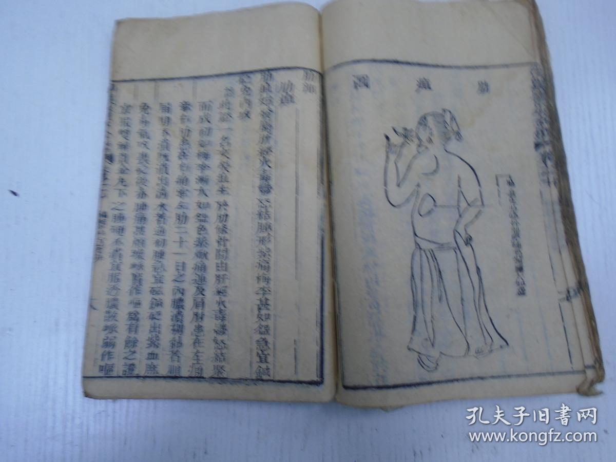 《御纂医宗金鑑》卷之六至卷之七/编辑外科心法要