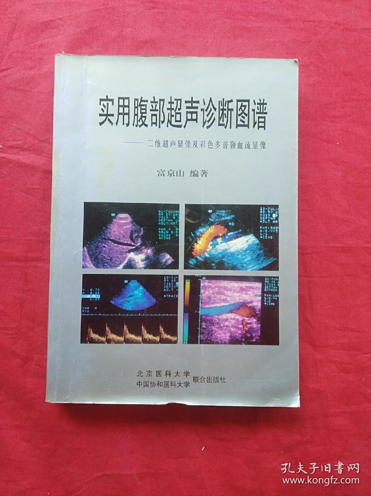 实用腹部超声诊断图谱:二维超声显像及彩色多普勒血流