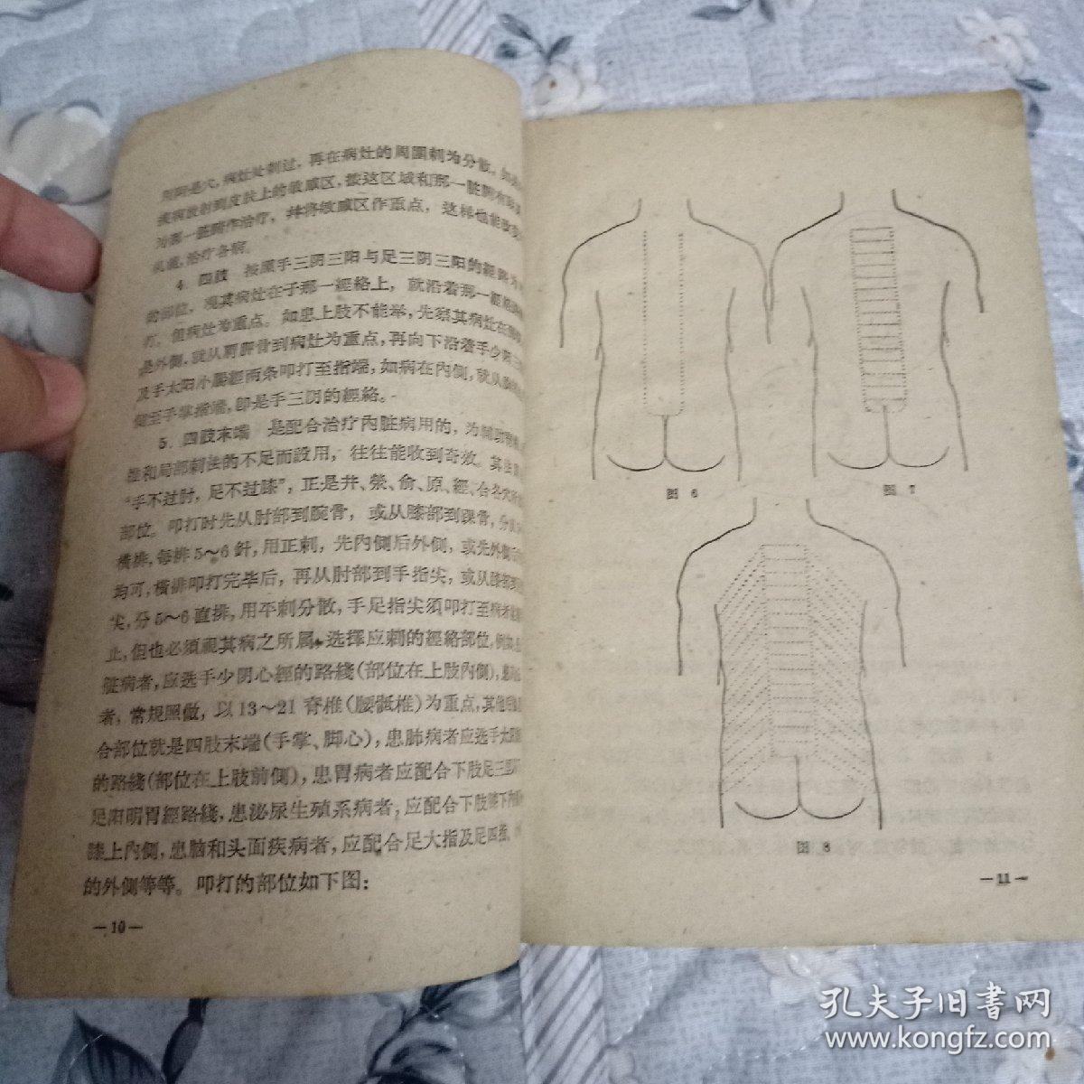 七星针疗法