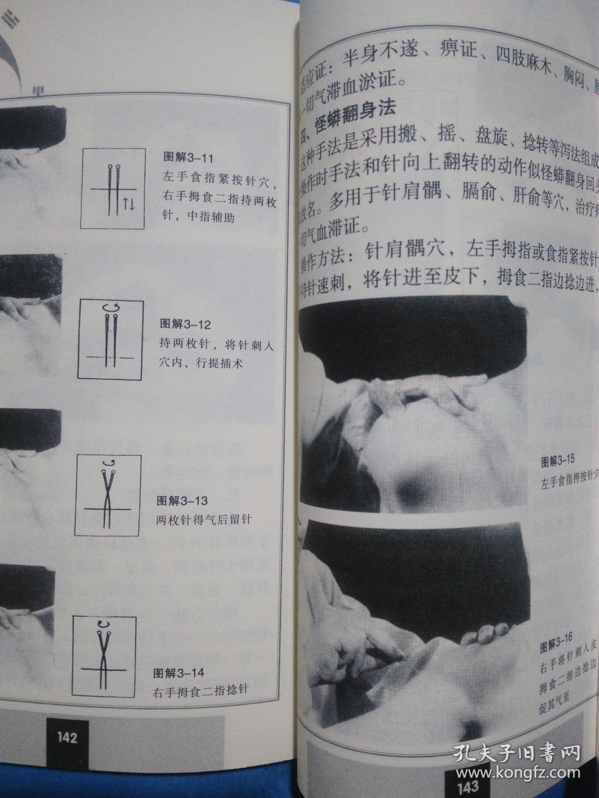 针灸补泻手法
