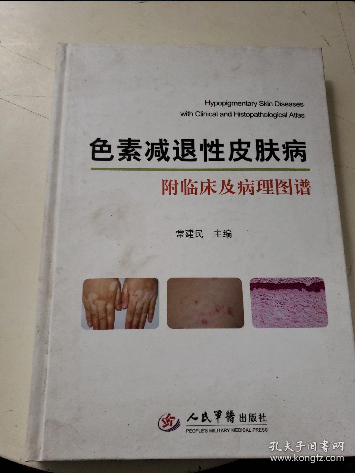色素减退性皮肤病:附临床及病理图谱