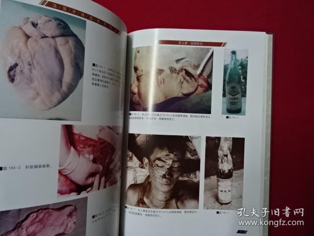 法医学铁道损伤图谱