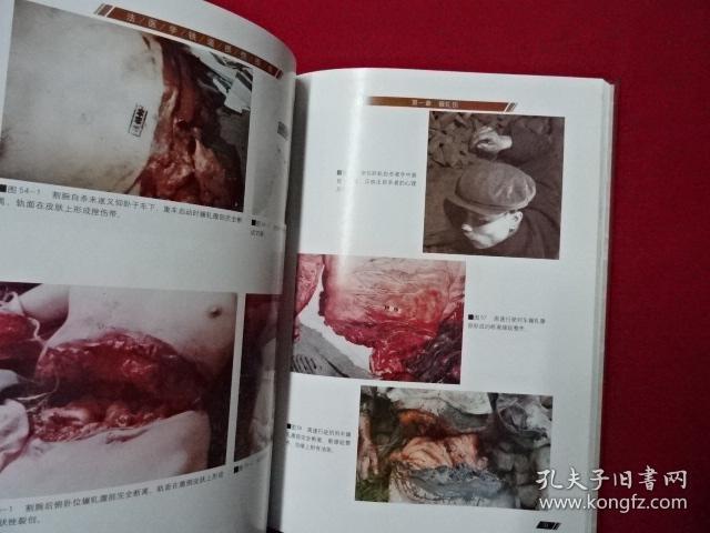 法医学铁道损伤图谱