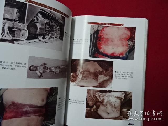 法医学铁道损伤图谱