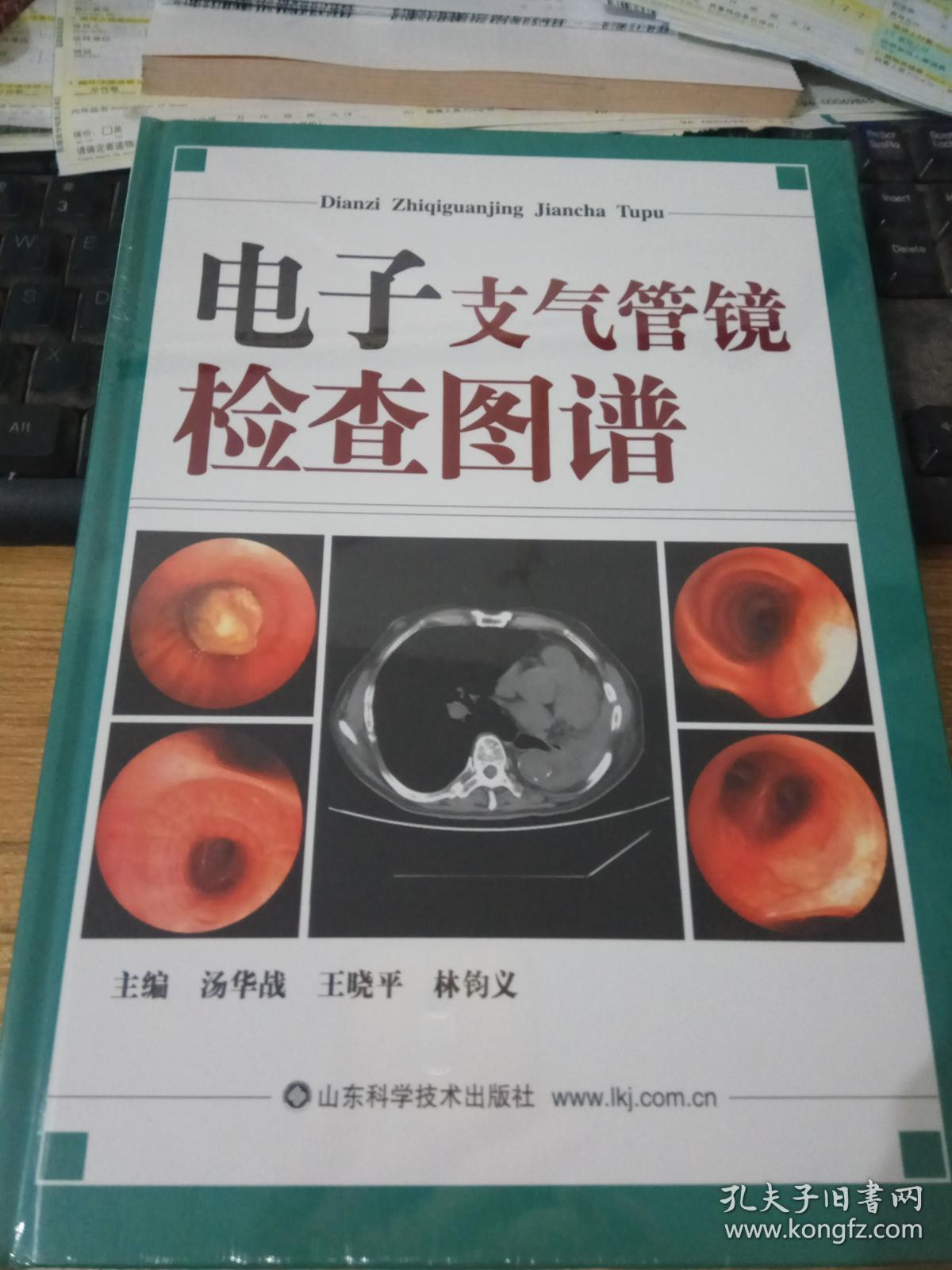 电子支气管镜检查图谱(大16开本精装新书,原塑封包装