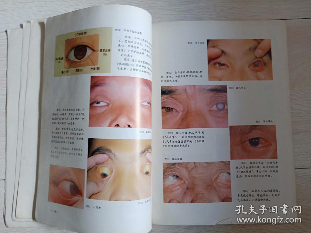 上海中医学院《中医望诊图谱》