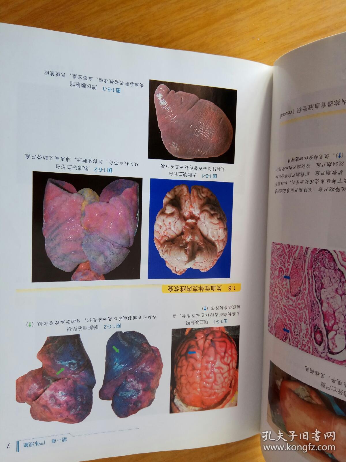 法医病理学图鉴