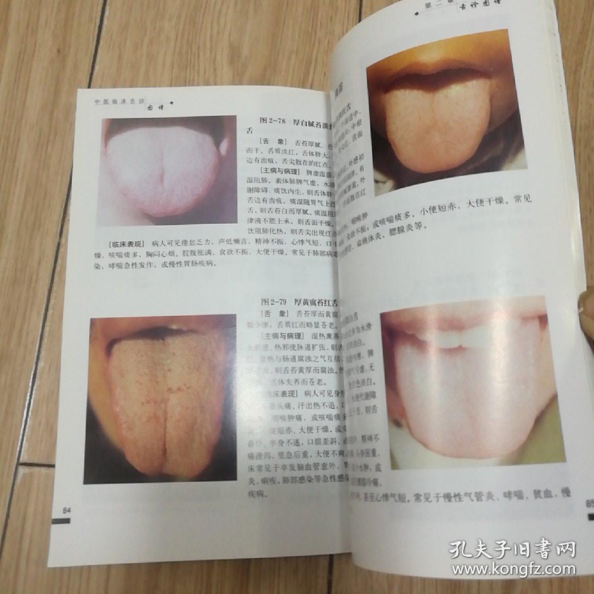 中医临床舌诊图谱【本书包括舌诊基本知识,舌象形成的
