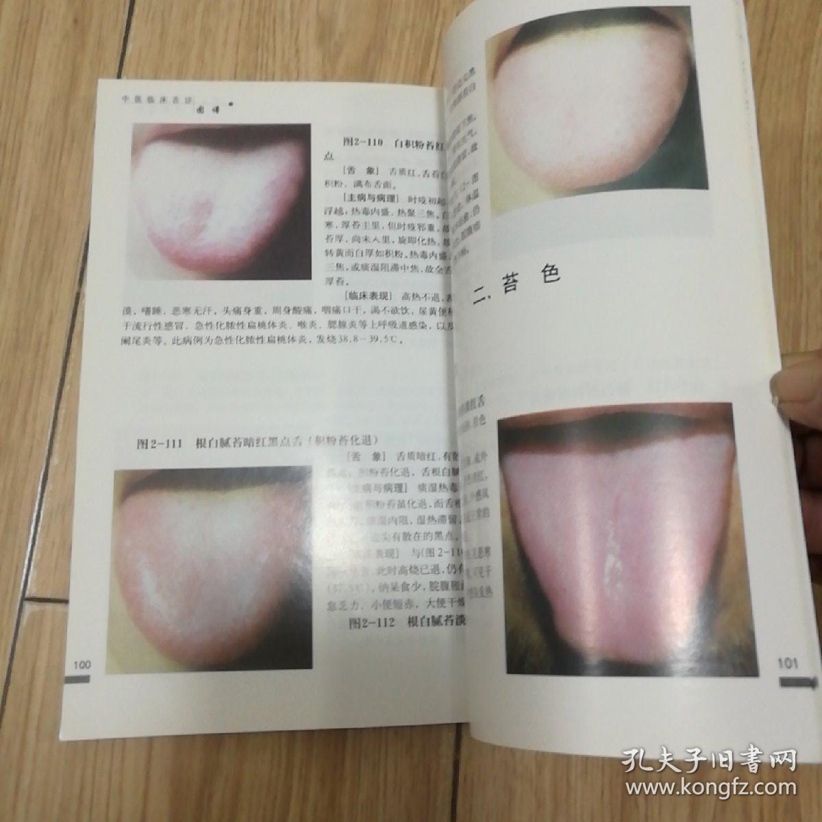 中医临床舌诊图谱【本书包括舌诊基本知识,舌象形成的