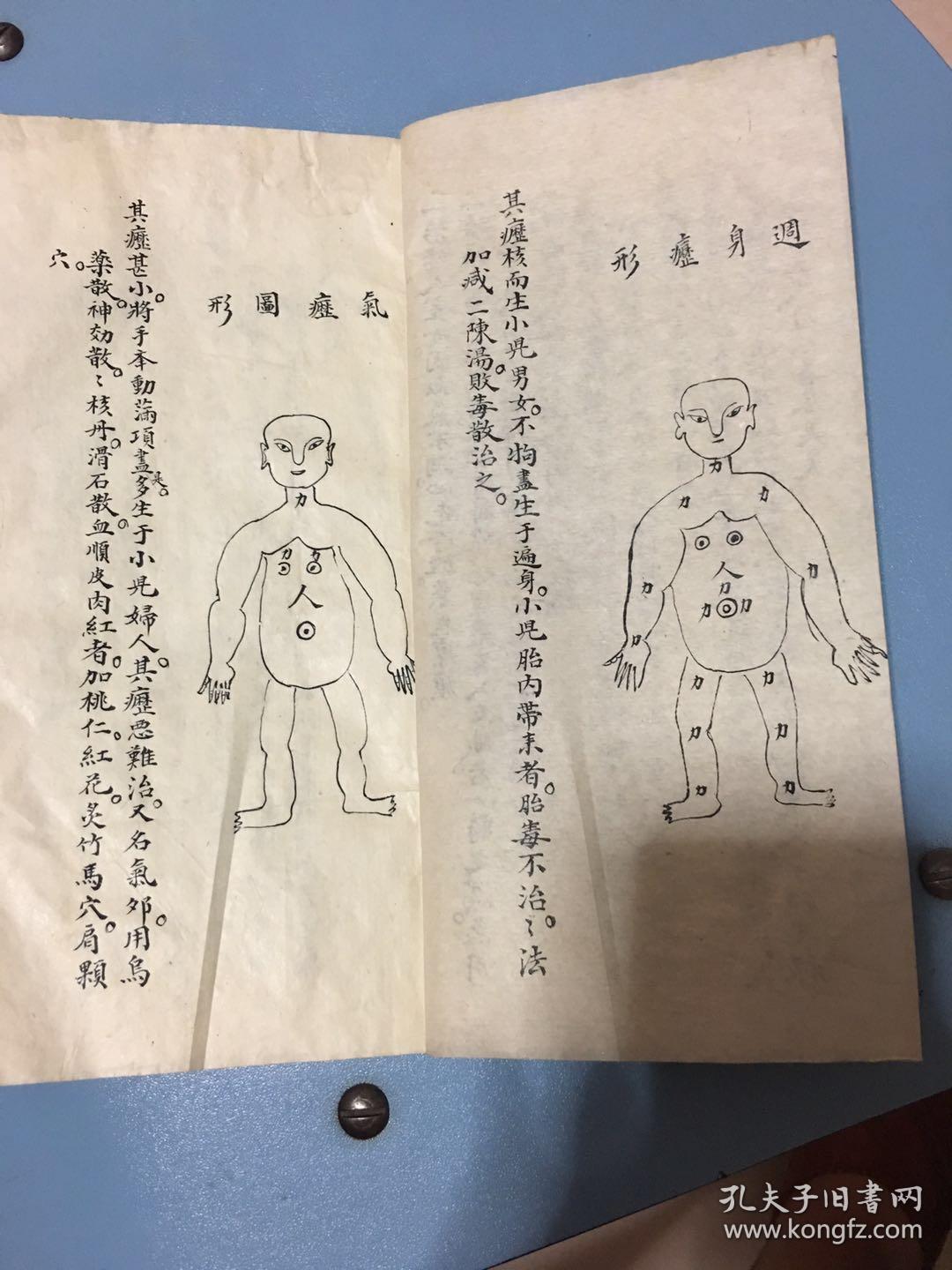仙家秘传全科瘰疬刑症 瘰疬又称淋巴结,俗称老鼠疮,乃中医至宝(复印件