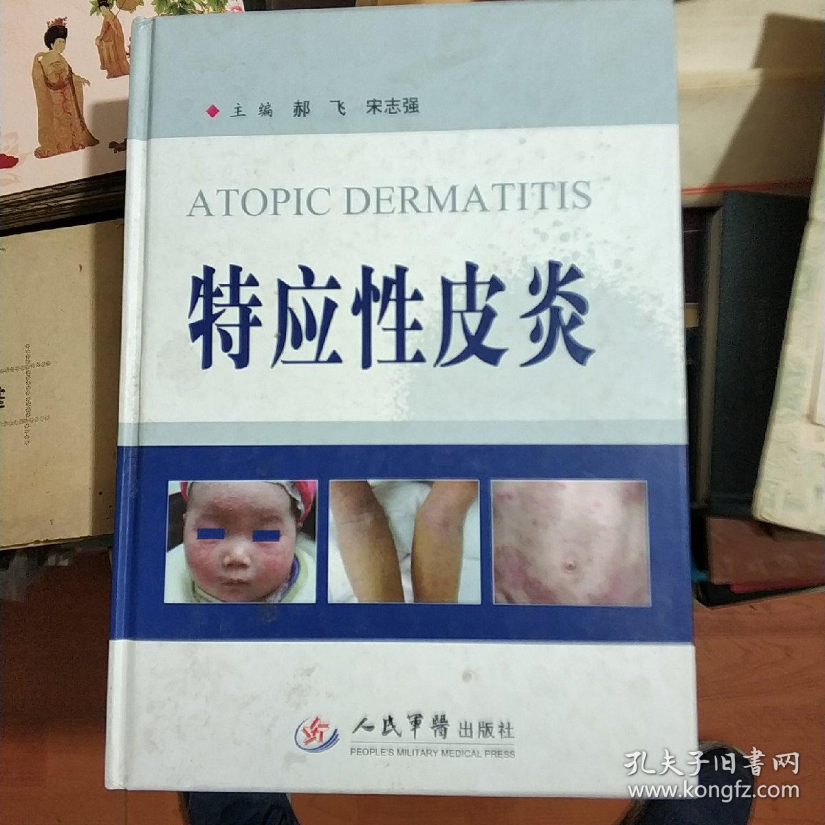 特应性皮炎