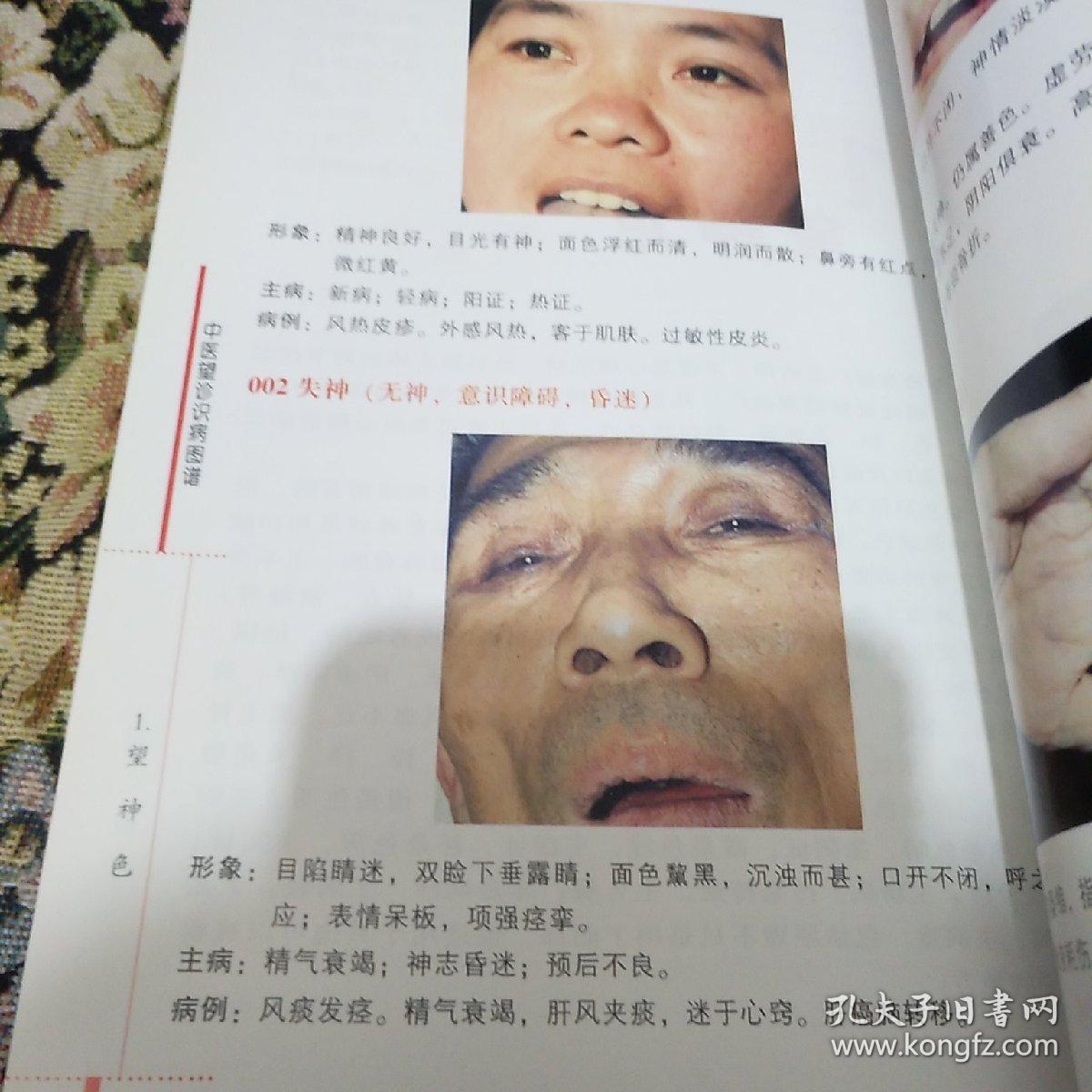 中医望诊识病图谱