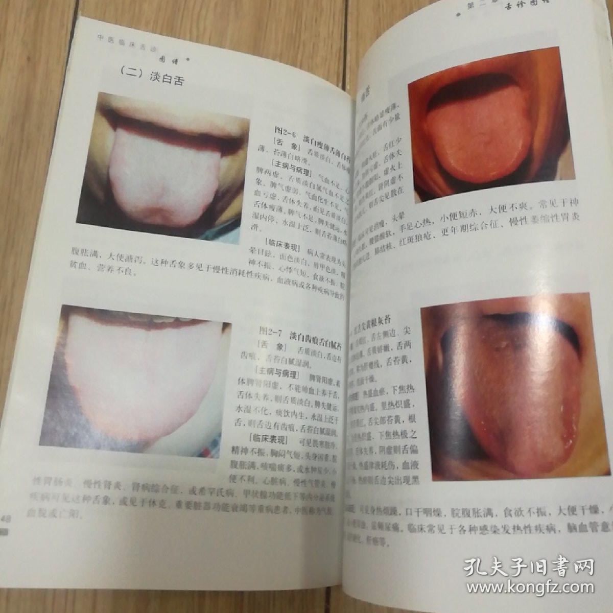 中医临床舌诊图谱【本书包括舌诊基本知识,舌象形成的