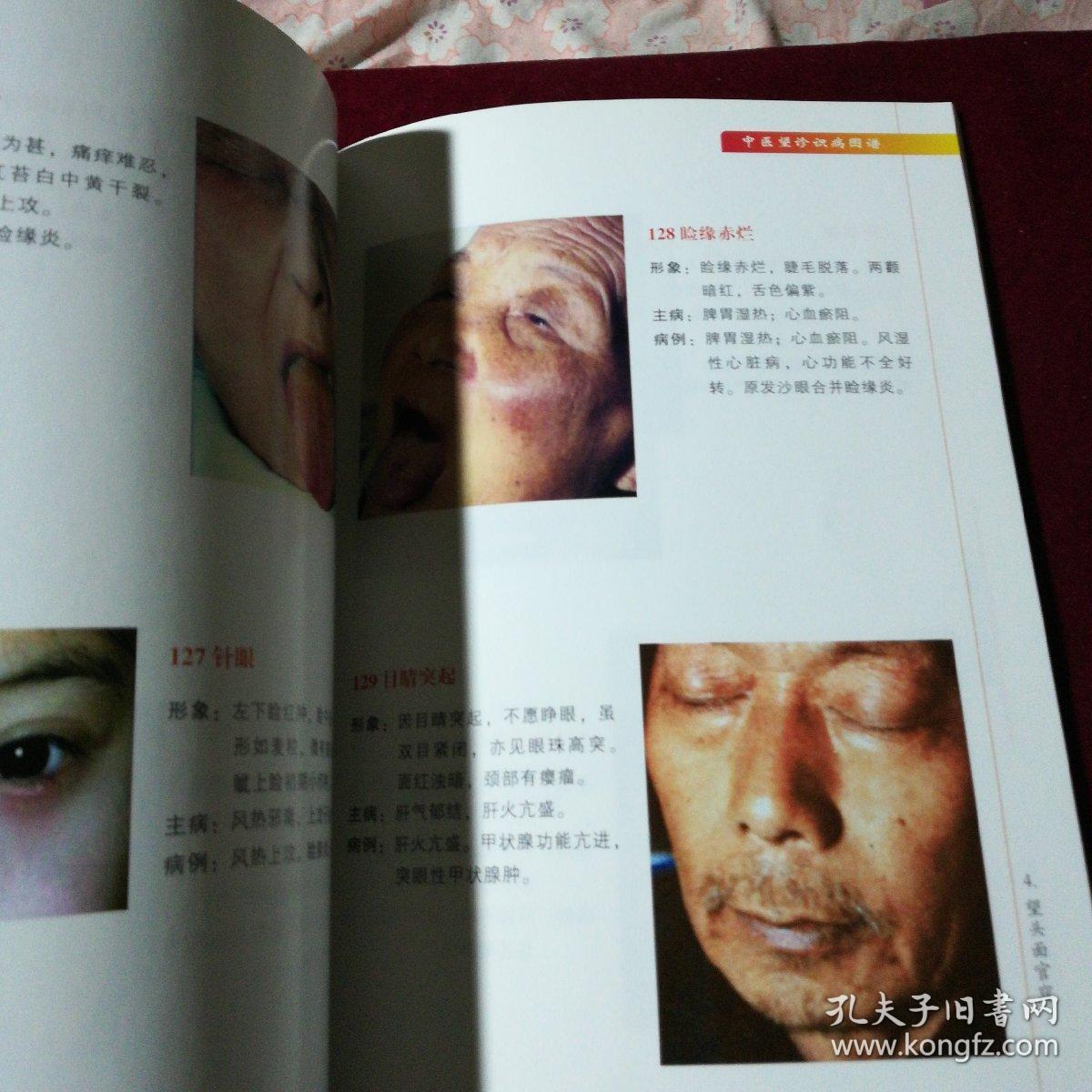 中医望诊识病图谱