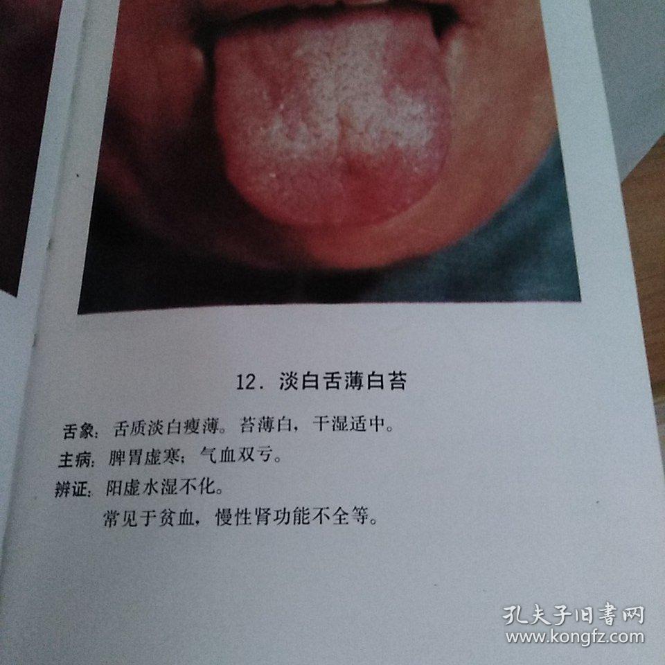 中医舌苔图谱