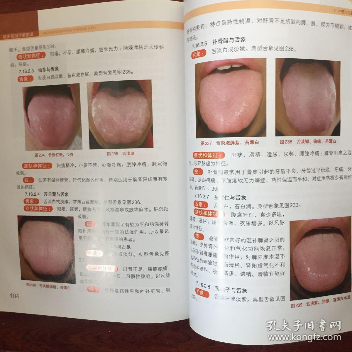 临床实用舌象图谱