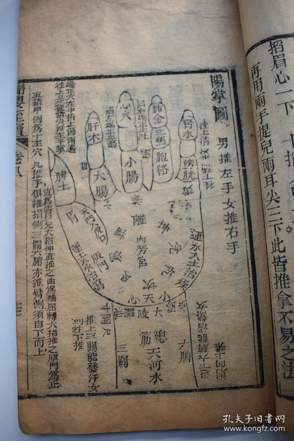 原装一册,卷八有大量图版:正面诸穴图,阳掌图,阴掌图,正面全身图,男左
