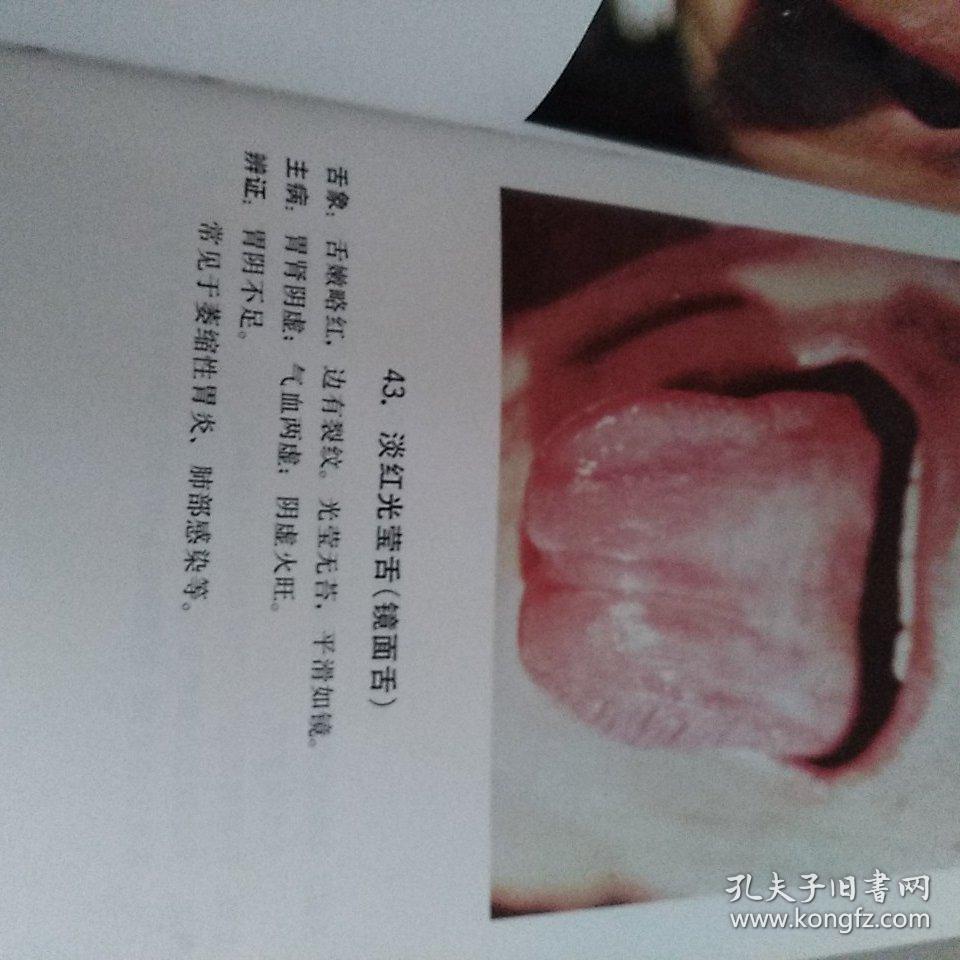 中医舌苔图谱